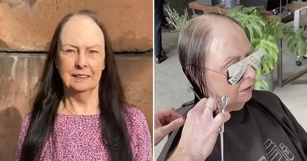 brenda6.jpg?resize=412,232 - Balding Woman Broke Down In Tears After Hair Replacement Treatment Left Her 'Looking 20 Years Younger'