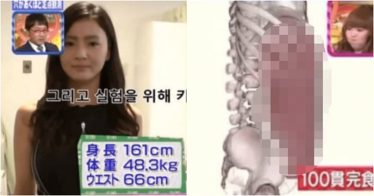collage 295.png?resize=412,275 - 무려 100피스의 초밥을 먹은 여성의 뱃속을 싹 다 찍어버리자 발견된 충격 모습