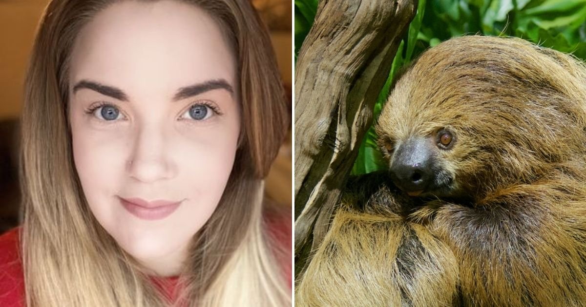 sloth.jpg?resize=412,232 - Mother 'Left Looking Like A Sloth' After Suffering A Severe Allergic Reaction To A Popular Beauty Treatment
