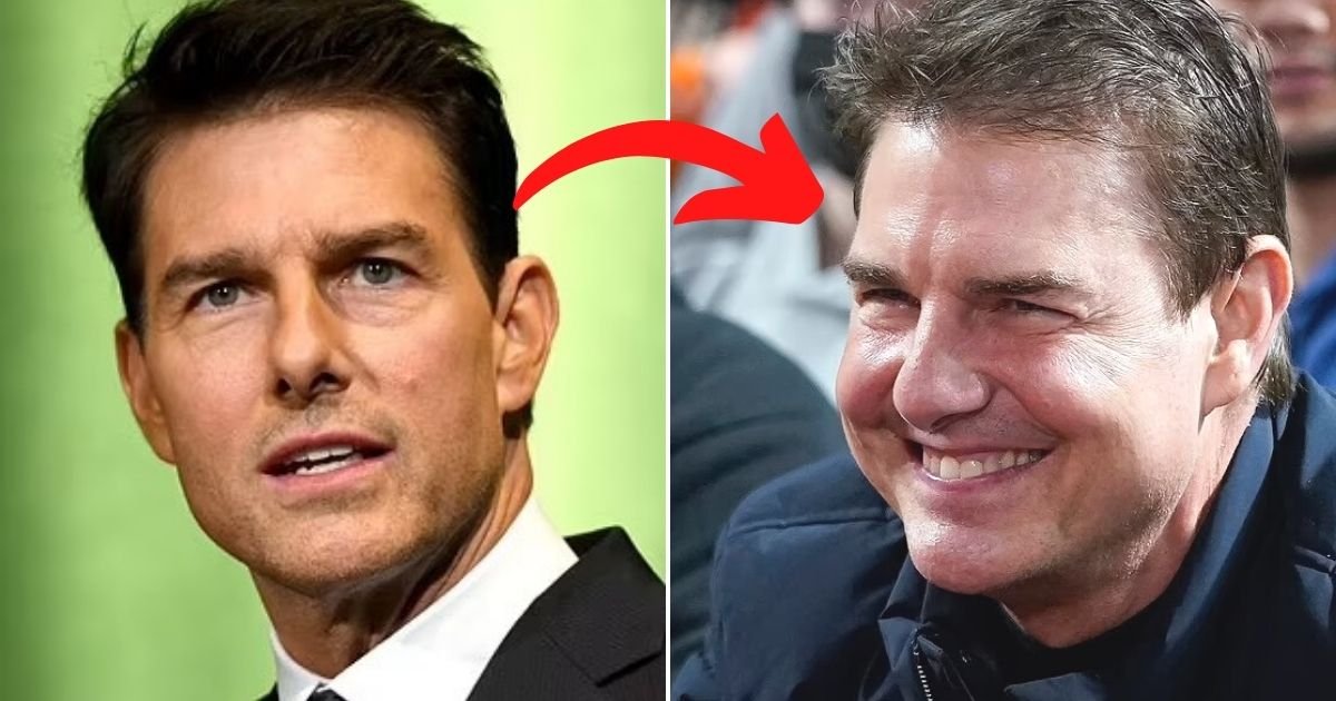 untitled design 46.jpg?resize=412,275 - Doctors Discuss Tom Cruise's New Looks And Reveal That The New Appearance Could Be A Result Of Cosmetic Procedures