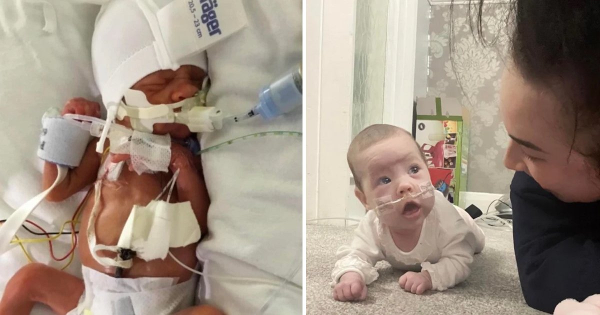 58.jpg?resize=412,275 - Premature Baby Born 14 Week Earlier Than Expected Has Survived Even After Having An Exceptionally Low Weight