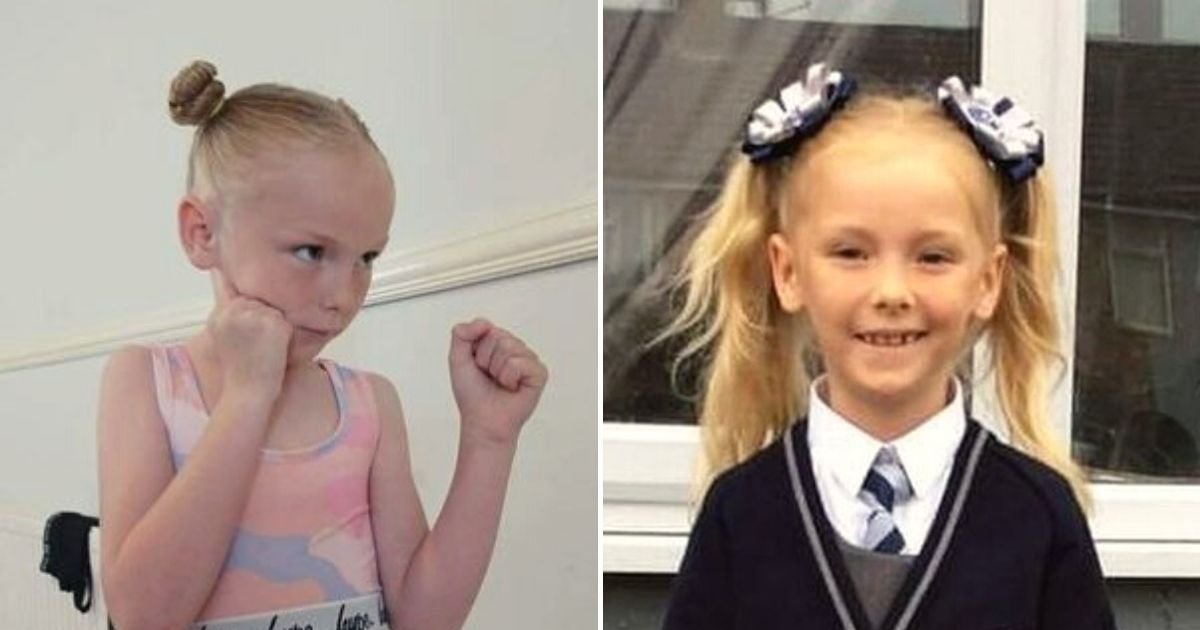 alexa6.jpg?fit=1024%2C538&ssl=1&strip=all - 6-Year-Old Girl Was Left Unable To Walk, Partially Deaf, And Blind After Being Crushed By A Heavy Fireplace