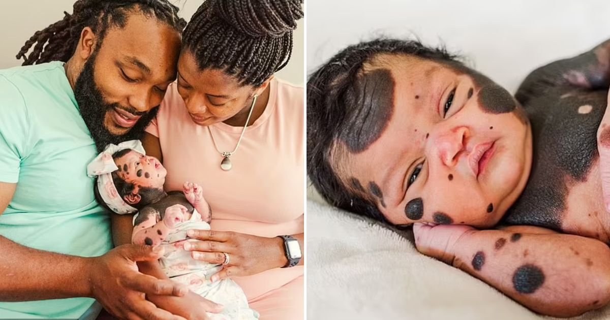 baby6.jpg?resize=1200,630 - Baby Girl Born With Dark Spots All Over Her Body Inspires Others To Embrace Their Unique Looks After Becoming An Internet Sensation