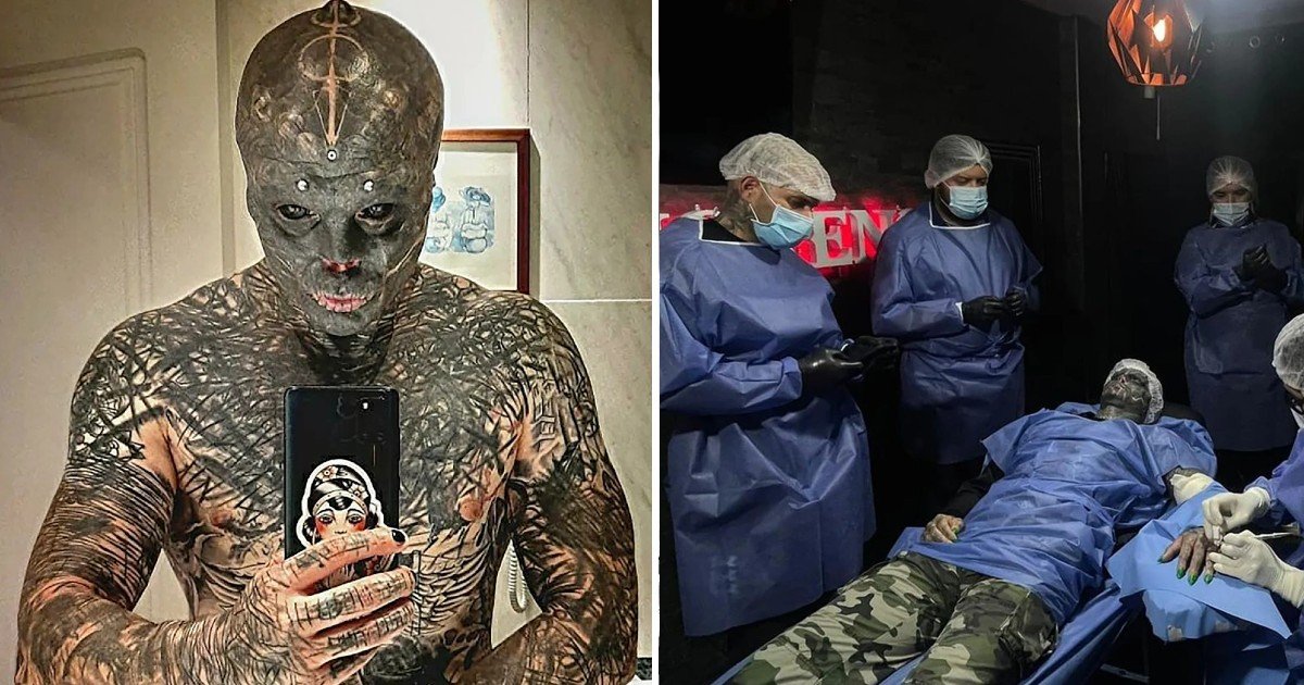 q1.jpeg?fit=1024%2C538&ssl=1&strip=all - Man Who Removed His Lip & Nose To Look Like A 'Black Alien' Now SLICES Fingers To Create Claw
