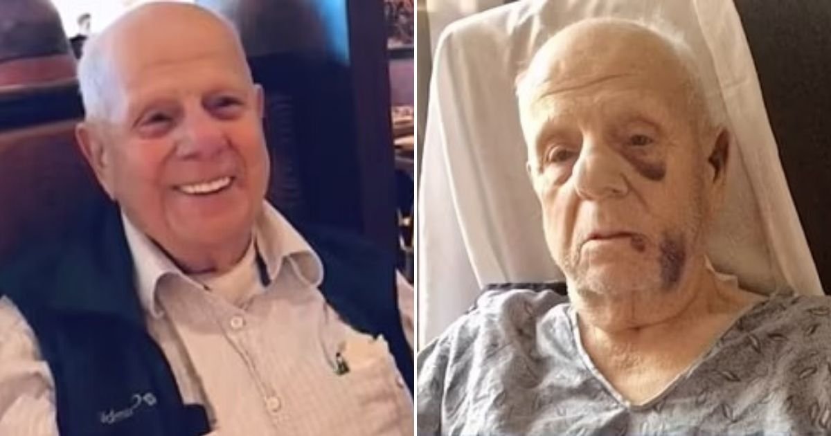 untitled design 82.jpg?fit=1024%2C538&ssl=1&strip=all - 82-Year-Old Man Left Covered In Bruises After Getting Beaten Up While Picking Up His Thanksgiving Turkey