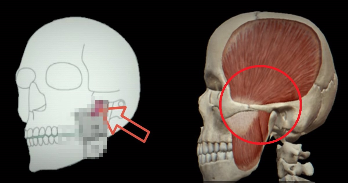 eab7bcec9ca1ec8db8.png?resize=412,275 - "아직까지도 풀리지 않은 인체의 신비"... 최근에 새롭게 발견된 사람의 턱 근육