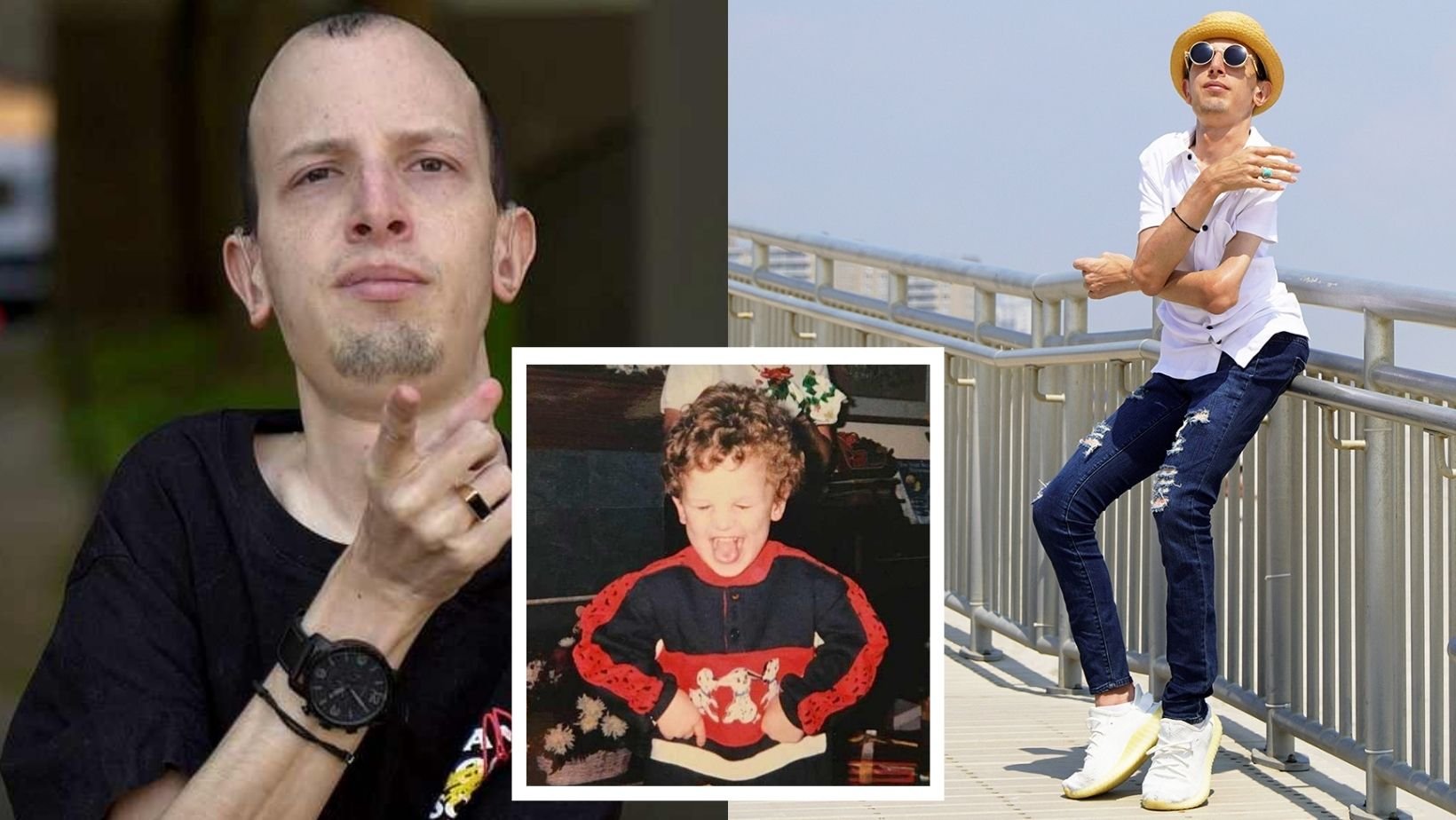 1 20.jpg?resize=1200,630 - YouTuber Shares His RARE Genetic Disorder That Turns His Muscles Into Bones