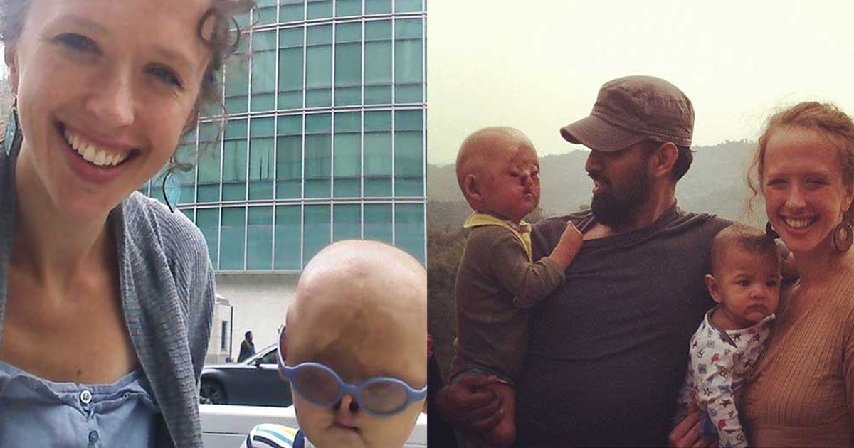111 3.jpg?resize=412,275 - Touching Moment As Loving Couple Adopts Baby 'Abandoned' By His Own Family Due To His 'Looks'