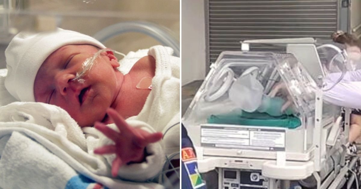baby5.jpg?fit=1024%2C538&ssl=1&strip=all - Preemie Baby Declared Dead By Doctors Was Found To Be ALIVE By A Funeral Director Who Noticed The Beating Of Its Heart