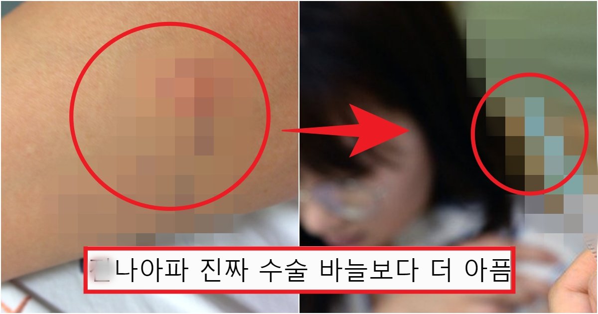 collage 234.jpg?resize=412,275 - '이 정도면 뭐 괜찮겠지...' 바늘 굵기가 별거 없어서 안 아프겠지 했다가 큰코다치는 주사