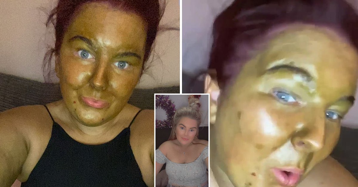 d97.jpg?resize=412,275 - Major Body Tan Disaster Turns ‘Pale As A Ghost’ Woman’s Skin Into A Dark Shade Of GREEN