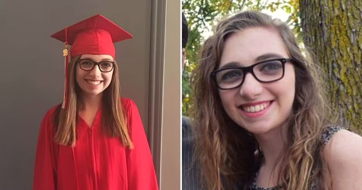 durand4.jpg?fit=1024%2C538&ssl=1&strip=all - 22-Year-Old Student Loses Her Nose, Lips, Ears, And Most Of Her Face Below Her Eyes After She Was Mauled By Two Dogs