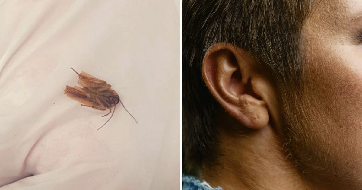 roach2.jpg?resize=1200,630 - 'A Cockroach Moving Inside My Head!': 40-Year-Old Man Had An Insect Burrowed Inside His Left Ear After Going For A Swim