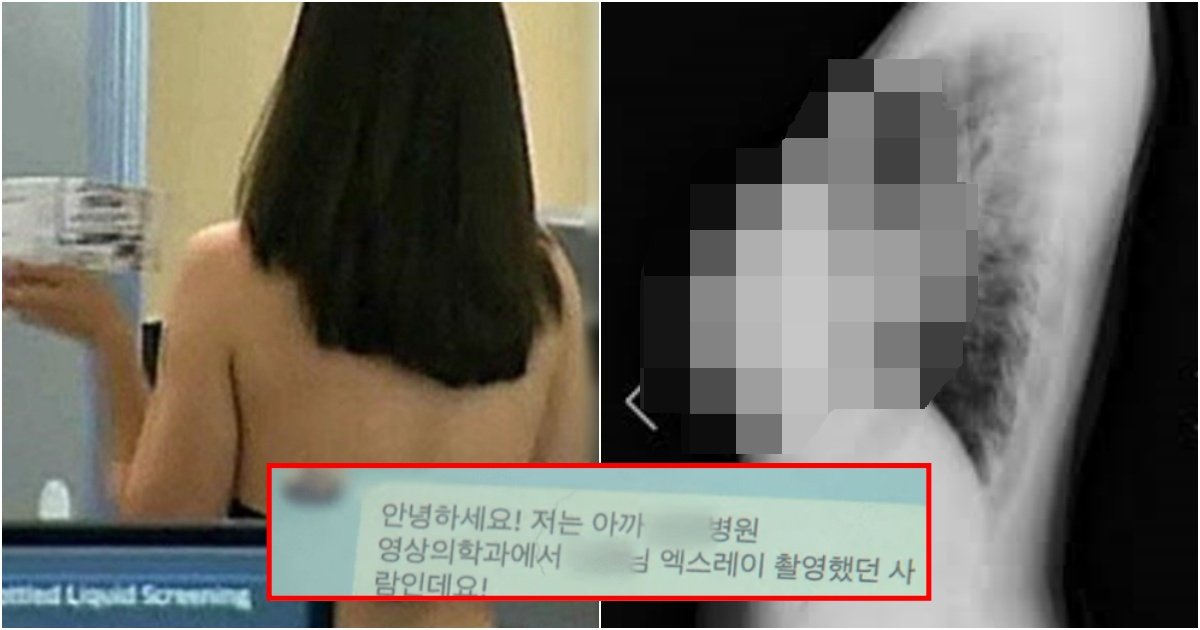 collage 193.jpg?resize=412,275 - 20대 여성이 흉부 엑스레이 찍었는데 모양과 크기를 보고 방사선사가 보낸 카톡