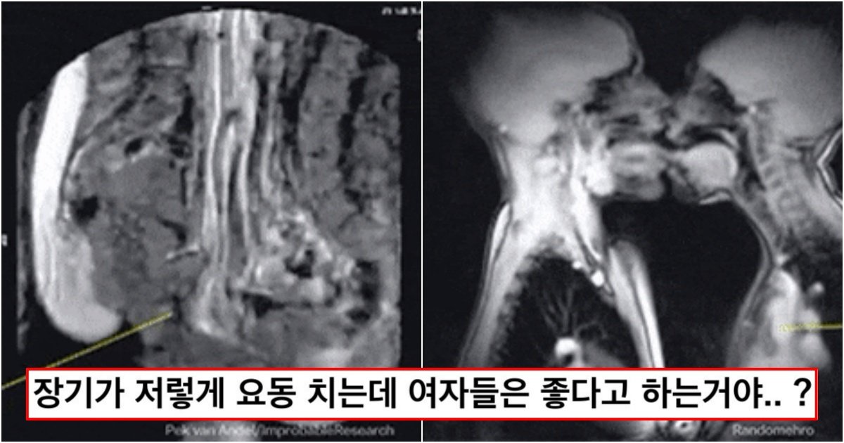 collage 400.jpg?resize=412,275 - "여자장기 막 흔들리는데.. 이게 좋다고..?" 남녀관계 순간 ‘MRI’로 찍었다가 대박난 20년 전 연구 영상