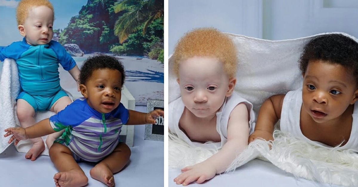 q6 3.jpg?resize=412,275 - Mom Sets Record Straight About Her 'Black & White' Biologically Identical Twin Baby Boys