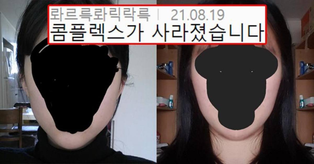 safe image 24.jpeg?resize=412,275 - 우리가 안면 비대칭에 절대 집작할 필요 없는 이유