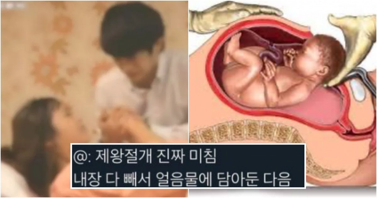 collage 184.jpg?resize=412,275 - "제왕절개 실체를 알고 남편과 이혼했습니다.." 여성들 사이에서 난리 난 제왕절개의 충격 사실 (사진)