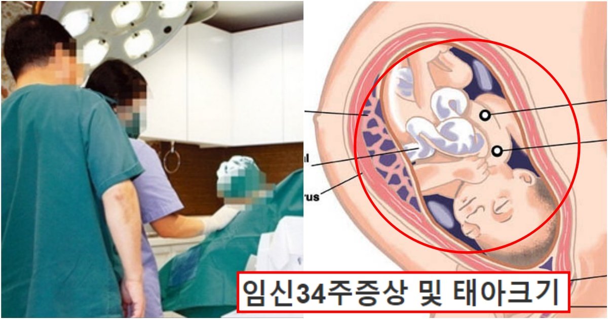 collage 192.jpg?resize=412,275 - 임신 34주차 산모의 부탁에 '낙X수술' 진행하다 아기가 죽음을 인지하고 울기 시작하자 의사가 저지른 행동