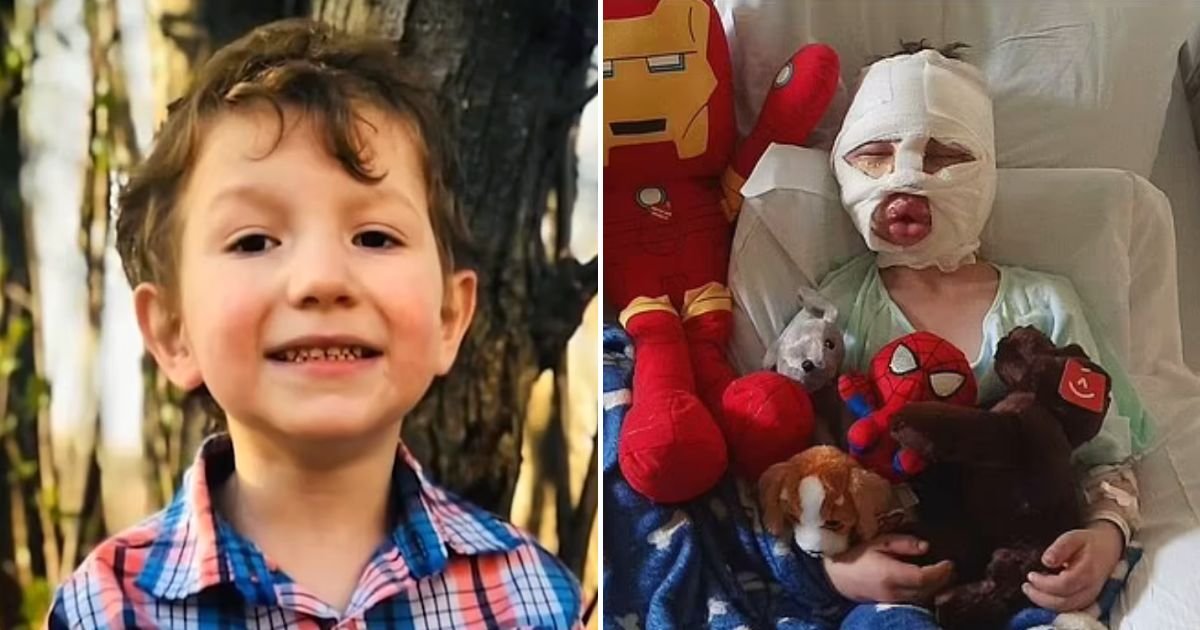 dom5.jpg?resize=412,275 - JUST IN: 6-Year-Old Boy Rushed To Hospital With Severe Burns After 8-Year-Old Bully Intentionally Lit Him On Fire