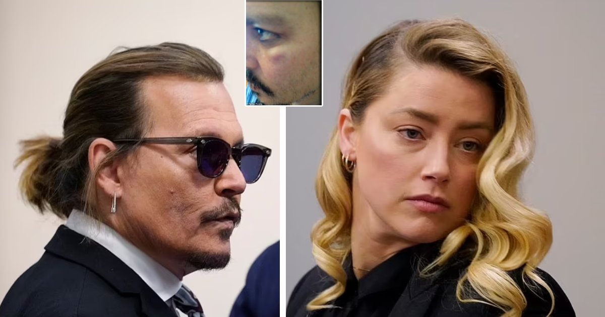 q1 6 1.png?resize=412,275 - JUST IN: Johnny Depp & Amber Heard’s Trial Takes A New Turn As Dramatic Images Of Depp’s Cuts & Bruises Shown In Court