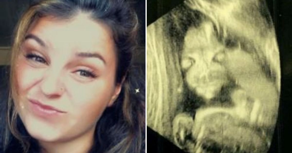 scan5.jpg?resize=1200,630 - 38-Year-Old Mother Scared Of Unborn 'Demon Child' As Her Baby Looks Like 'Salad Fingers' In Her First Scan
