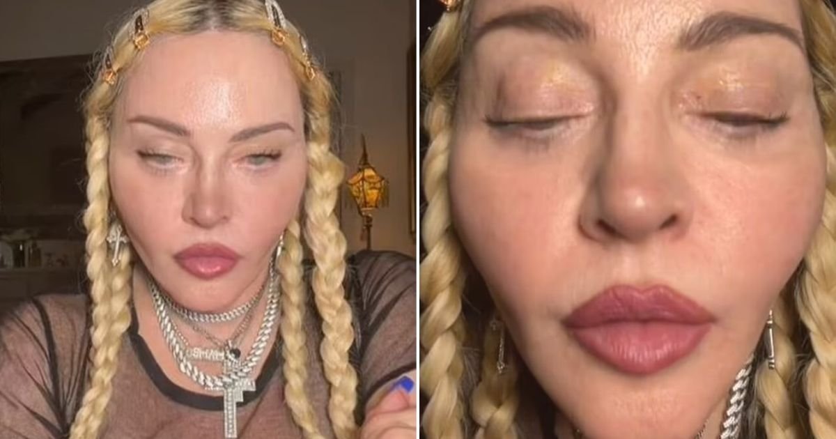 untitled design 26.jpg?resize=1200,630 - Madonna Sparks Concerns After Showing Off SWOLLEN Cheeks And PUFFY Lips In ‘Unnerving’ Video