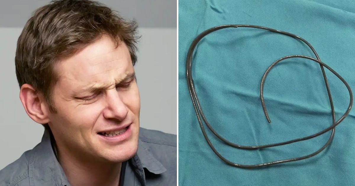 wire5.jpg?resize=1200,630 - Man Gets 30inch-Long Wire Stuck Inside His Body After Shoving It Down His Private Part While Pleasuring Himself