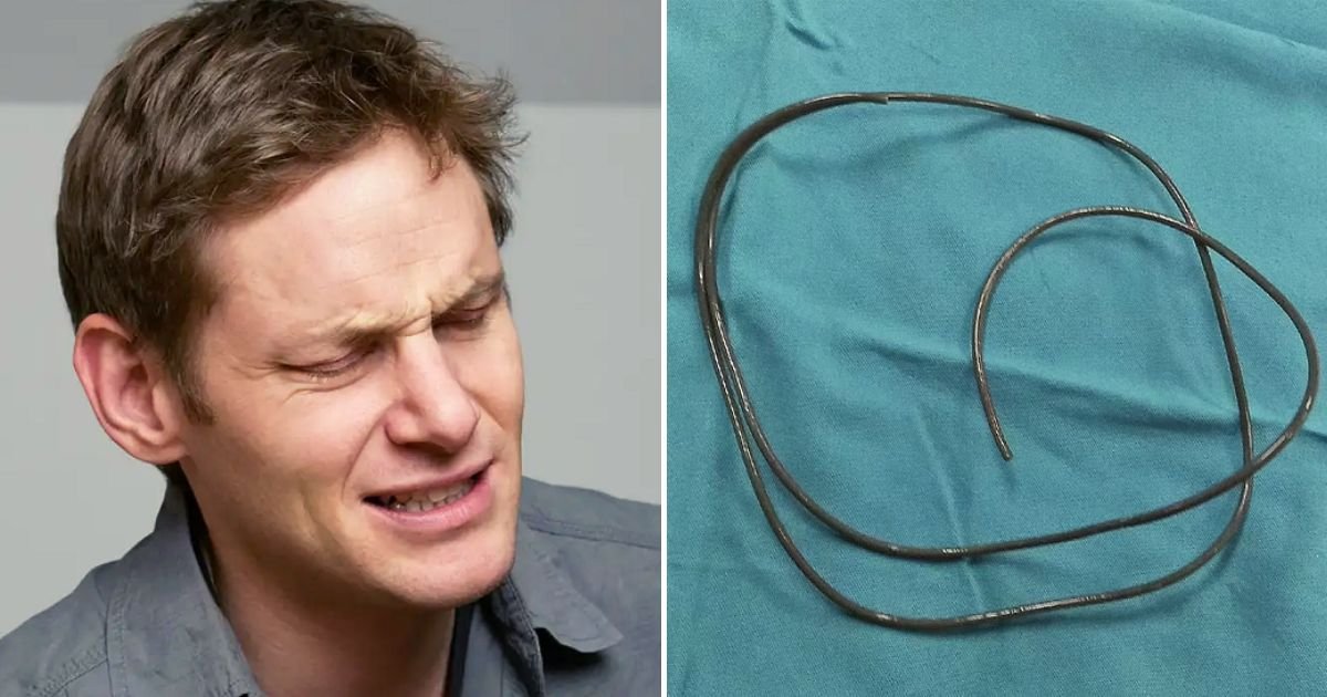 wire5.jpg?resize=412,275 - Man Gets 30inch-Long Wire Stuck Inside His Body After Shoving It Down His Private Part While Pleasuring Himself