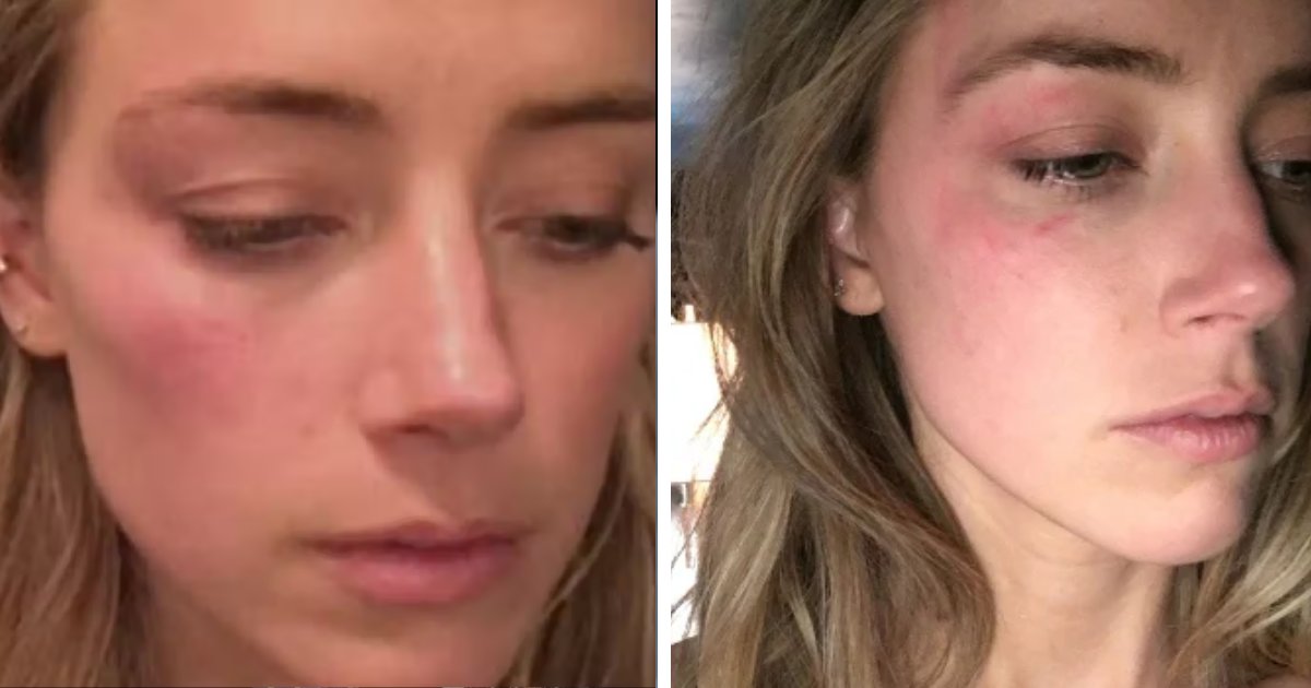 d2.png?resize=412,232 - BREAKING: Amber Heard Says Image Of Johnny Depp With TWO BLACK EYES Was 'Photoshopped'