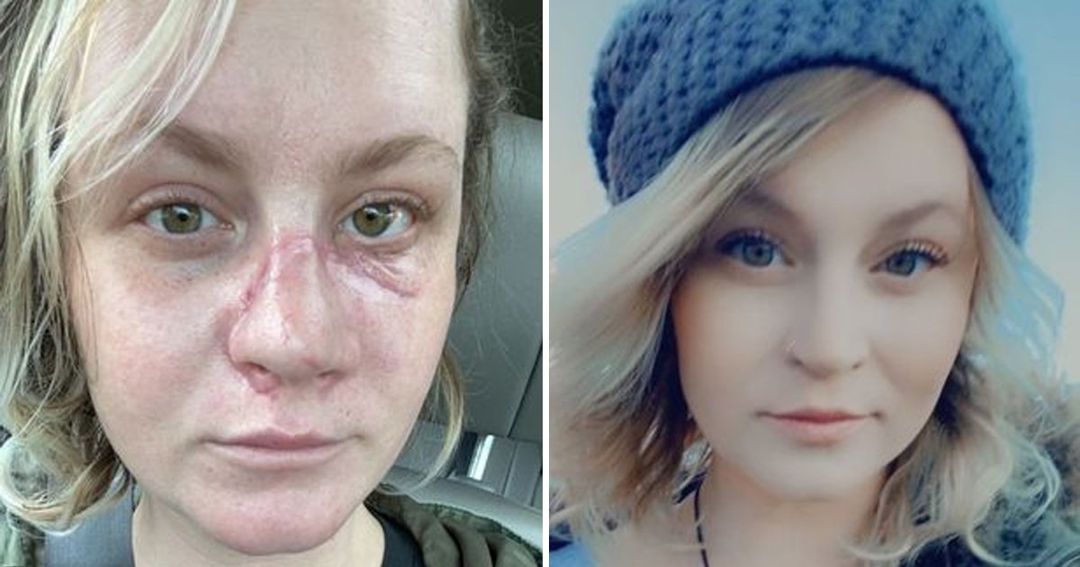 d81.jpg?fit=1024%2C538&ssl=1&strip=all - BREAKING: Horror Dog Attack Leaves Hairdresser SCARRED For Life After 'Wild Beast' RIPS Off Her Nose