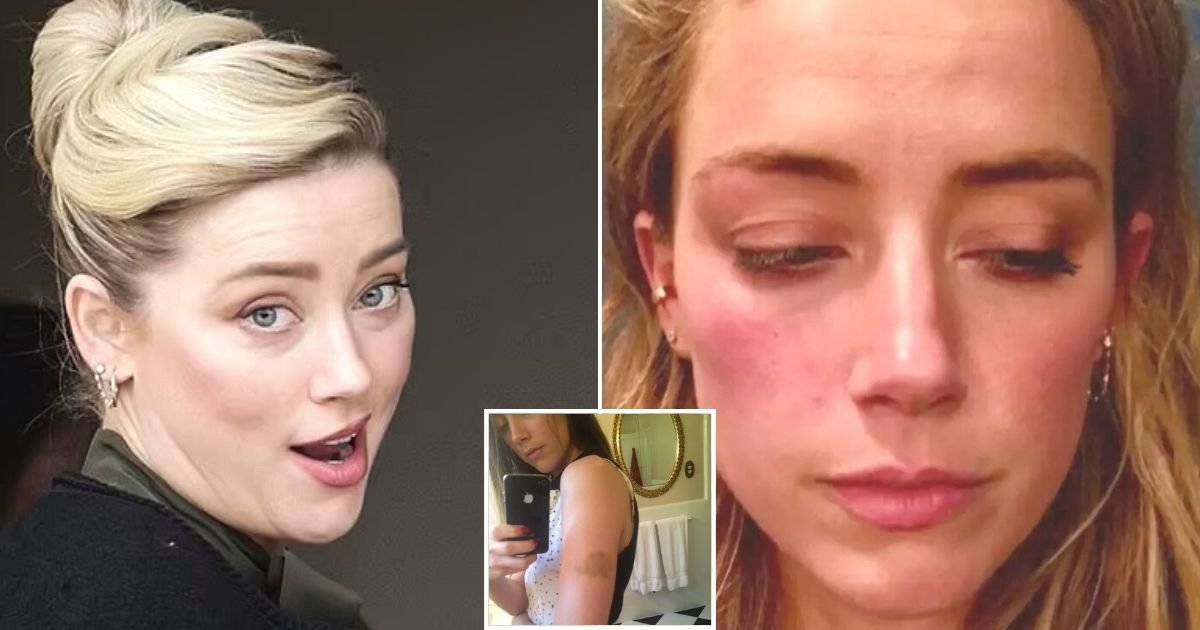 untitled design 87 1.jpg?resize=1200,630 - JUST IN: Photos Showing Amber Heard's Bruises Were EDITED, Digital Forensic Expert Testifies
