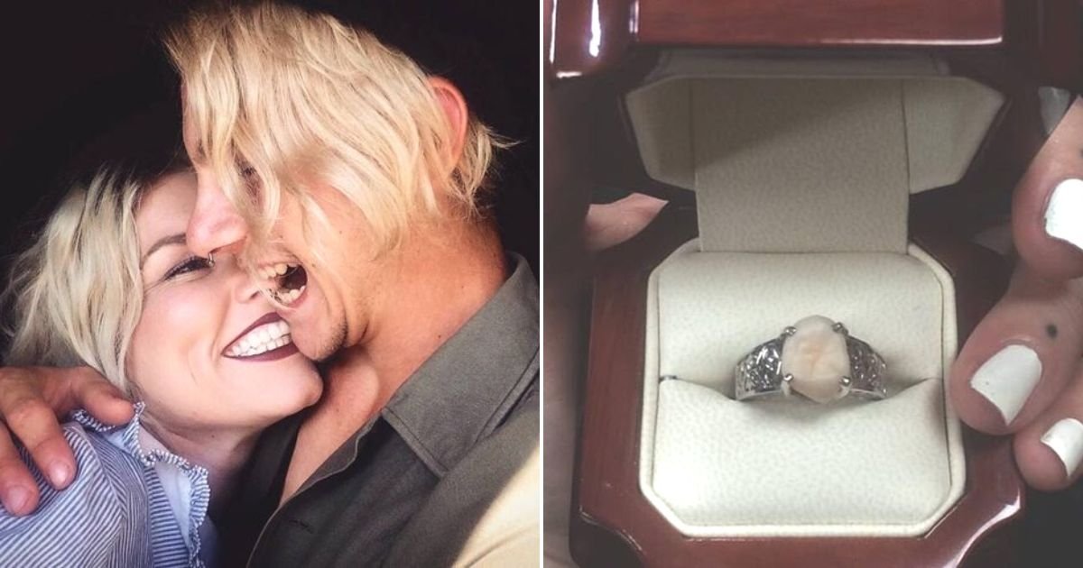 untitled design 98.jpg?resize=412,232 - Man Proposes To His Girlfriend Using An Engagement Ring Made Of His WISDOM TOOTH