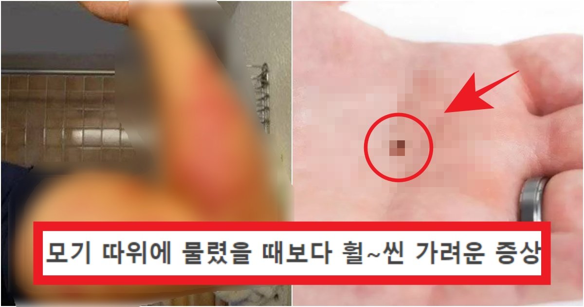 collage 323.jpg?resize=1200,630 - '바퀴벌레 아님..' 현재 한국에서 엄청나게 증가하고 있다고 하는 내성이 강한 '벌레'의 정체(+이유)