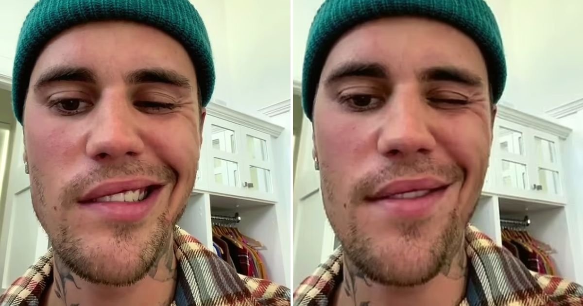 justin5.jpg?resize=1200,630 - Justin Bieber Is Struck By Facial Paralysis And Shares Fears As He Struggles To Eat After Being Forced To Postpone Next Few Tours