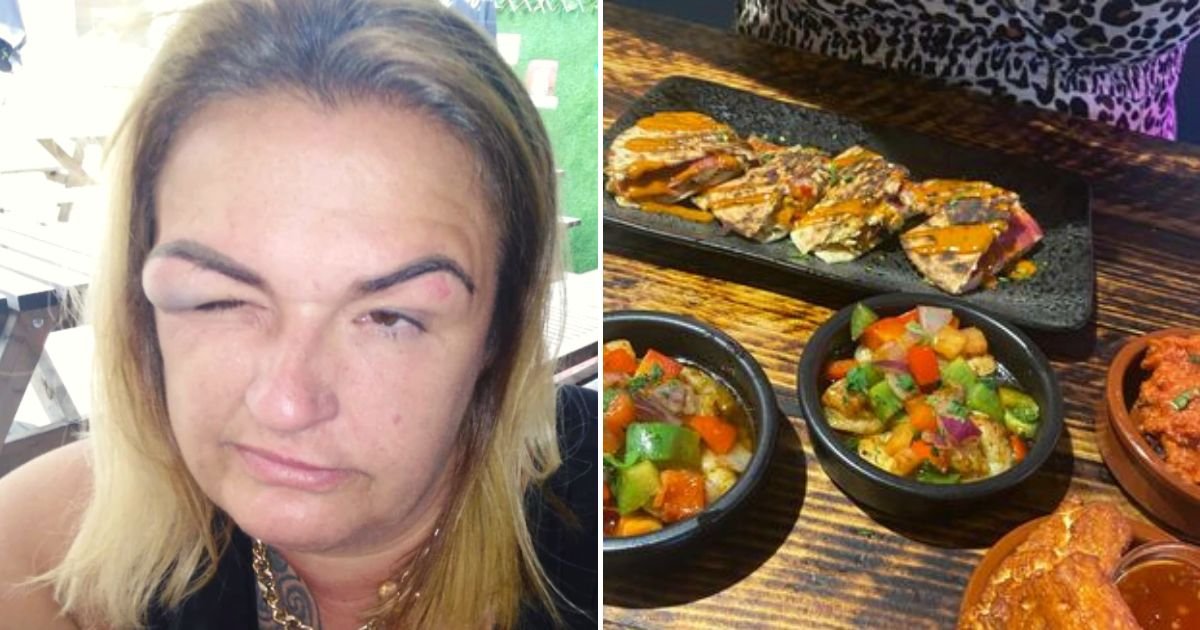 nat5.jpg?fit=1024%2C538&ssl=1&strip=all - 43-Year-Old Grandmother Left With Swollen Face And Concussion After Epic Bottomless Brunch With Her Best Friend