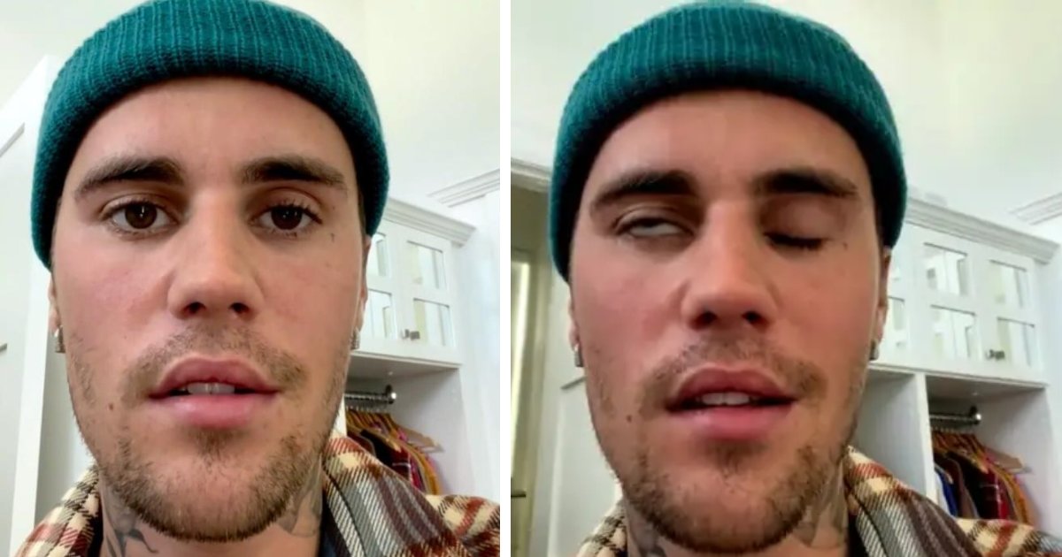 q3 2 1.png?resize=412,232 - EXCLUSIVE: Doctors Give Update On Justin Bieber's Facial Paralysis