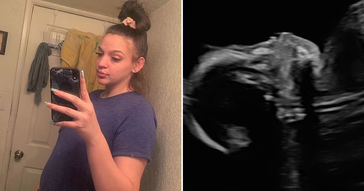 chloe5.jpg?resize=412,275 - Woman Pregnant With A Baby Who Is 'INCOMPATIBLE With Life' Reveals Torture Of Having To Feel Unborn Child's Sufferings Every Day