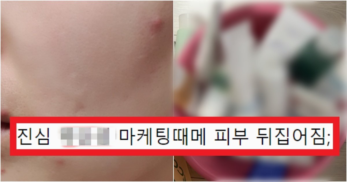 collage 104.jpg?resize=412,275 - '충격적이다..계속 썼는데' 많은 사람들이 엄청 헷갈려하는 '피지'많은 사람들의 폼클렌징(+충격)