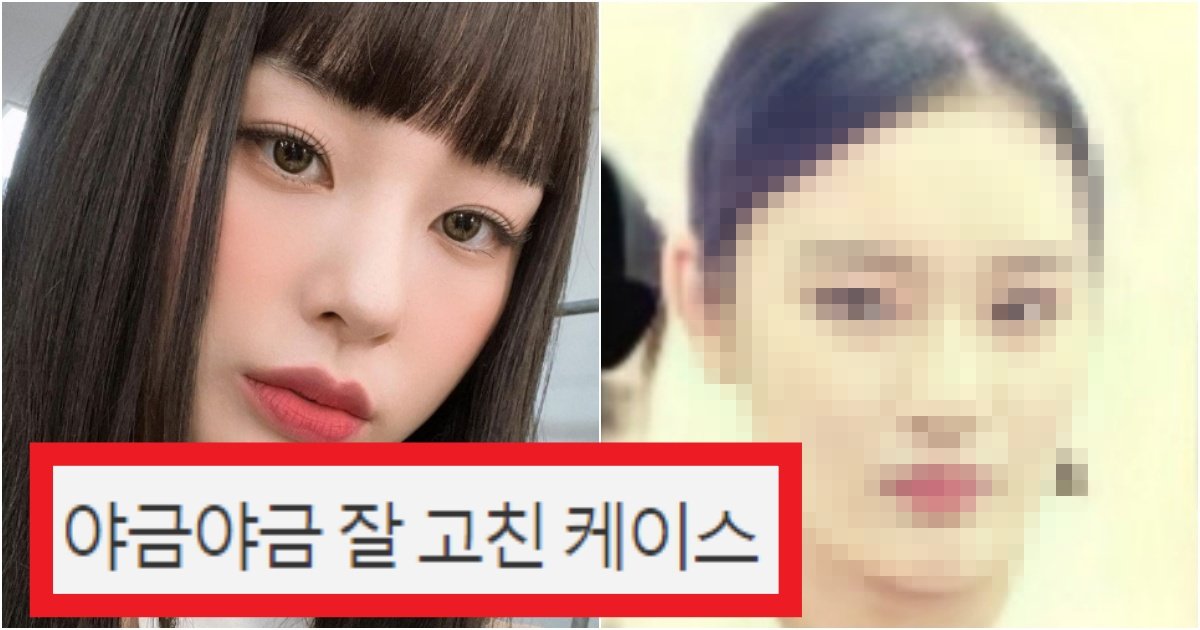 collage 111.jpg?resize=412,275 - '박나래 아니야..?' 현재 커뮤니티에서 난리 난 스우파 '노제' 성형 전 사진(+댓글)