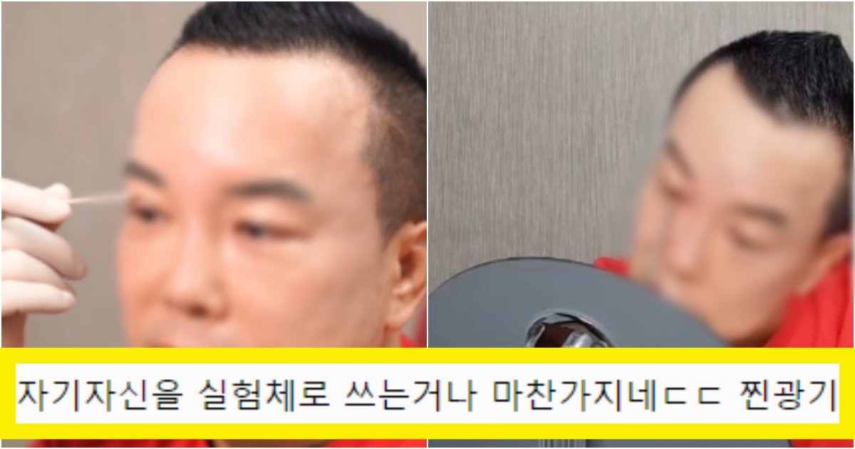 collage 294.jpg?resize=412,275 - '저렇게나 많은 수술을..?' 다른 병원 가지 않고 '셀프'로 혼자 쌍꺼풀 하는 의사(+다른 셀프시술 공개)