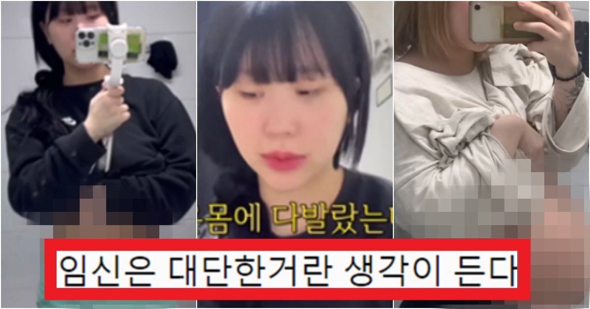collage 328.jpg?resize=412,275 - '이게 뭐야...? 온 몸에..?' 튼살크림을 계속해서 발랐는데 생겨버린 '조두팔' 근황(+사진들)