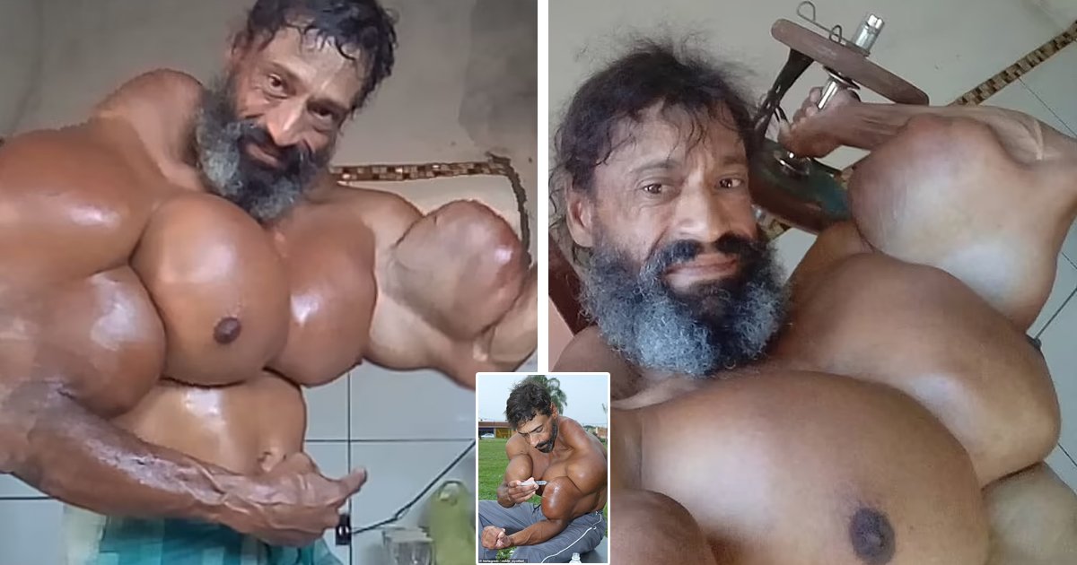 8.jpg?resize=412,275 - TikTok Star Dubbed 'Brazilian Hulk' Who Gained Fame For Injecting OIL To Produce His 'Mighty' Biceps DIES