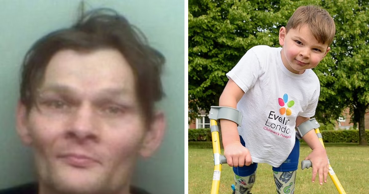 d2 4.png?fit=1024%2C538&ssl=1&strip=all - BREAKING: Parents Who TORTURED '41-Day-Old' Baby So BAD That He 'Lost Both Legs' Will Be FREED From Jail