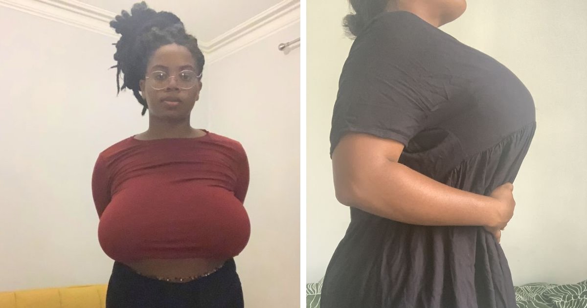 t3 12.png?fit=1024%2C538&ssl=1&strip=all - "My 34K Cleavage Is So HUGE, It Keeps Knocking Things Over!"- Woman Says She's Forced To Suffer Intense Back Pain Due To Her Condition