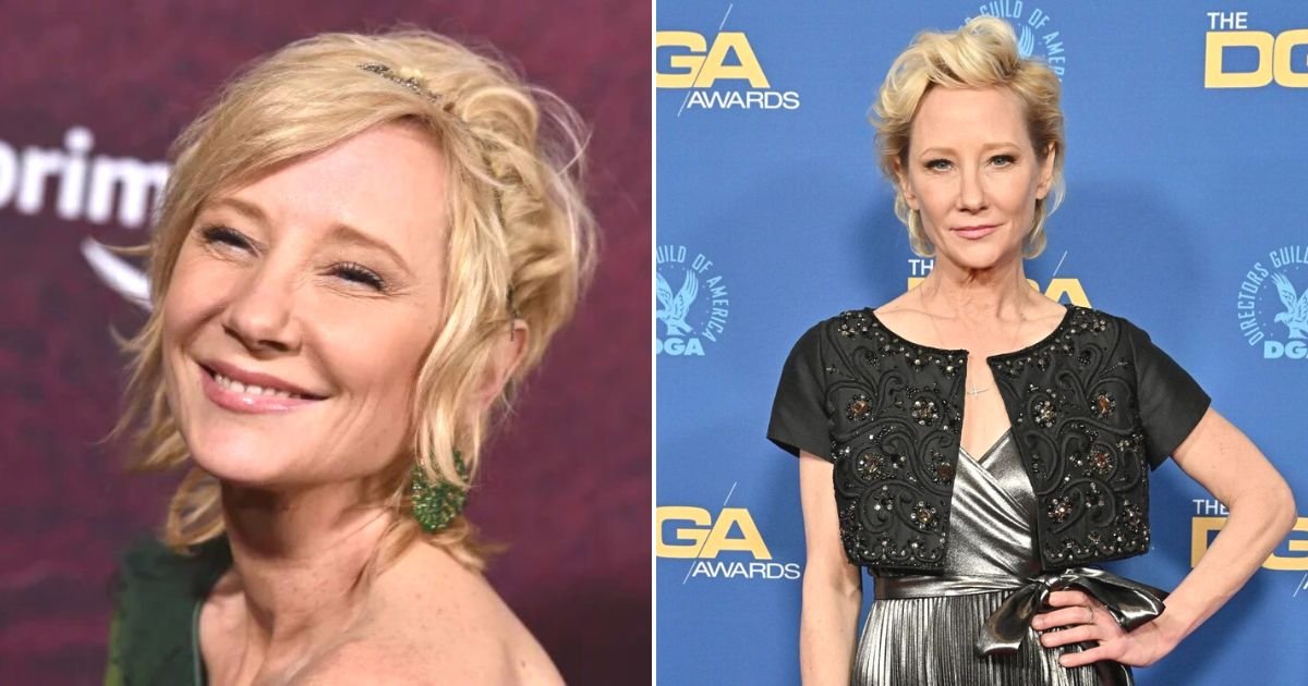 untitled design 45.jpg?fit=1024%2C538&ssl=1&strip=all - BREAKING: Anne Heche Is Pronounced BRAIN DEAD Following Her Car Crash