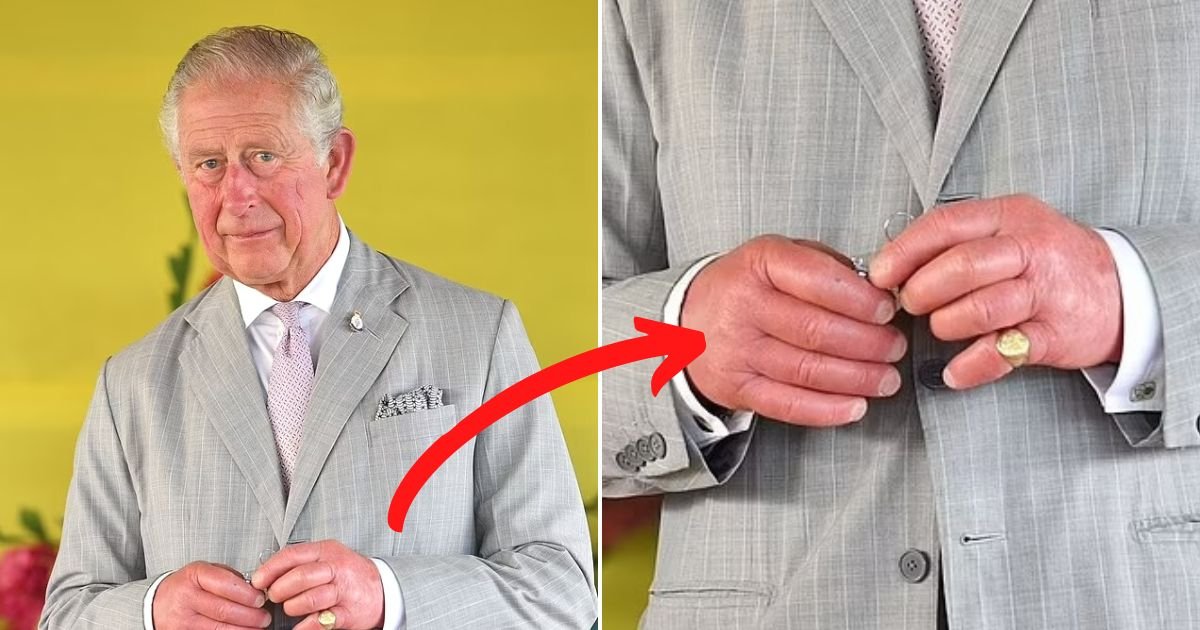 Fears For King Charles Health After Photos Showing His SWOLLEN Fingers   2 11 