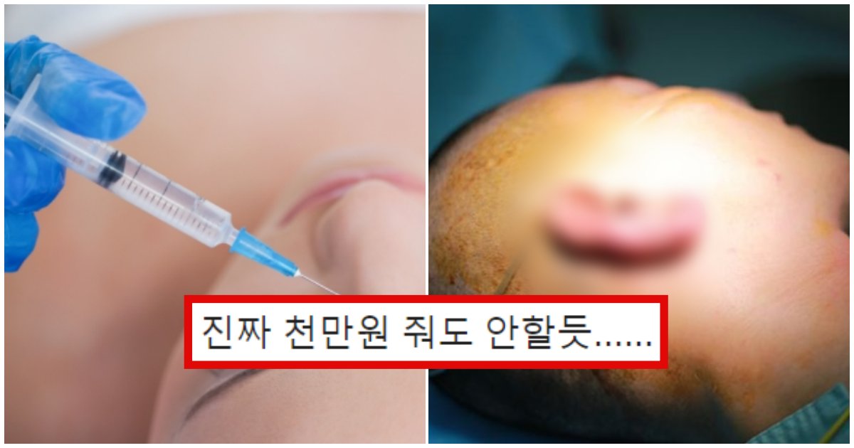 collage 114.png?resize=1200,630 - 한국인들은 '돈준다'해도 절대 안한다는 성형수술