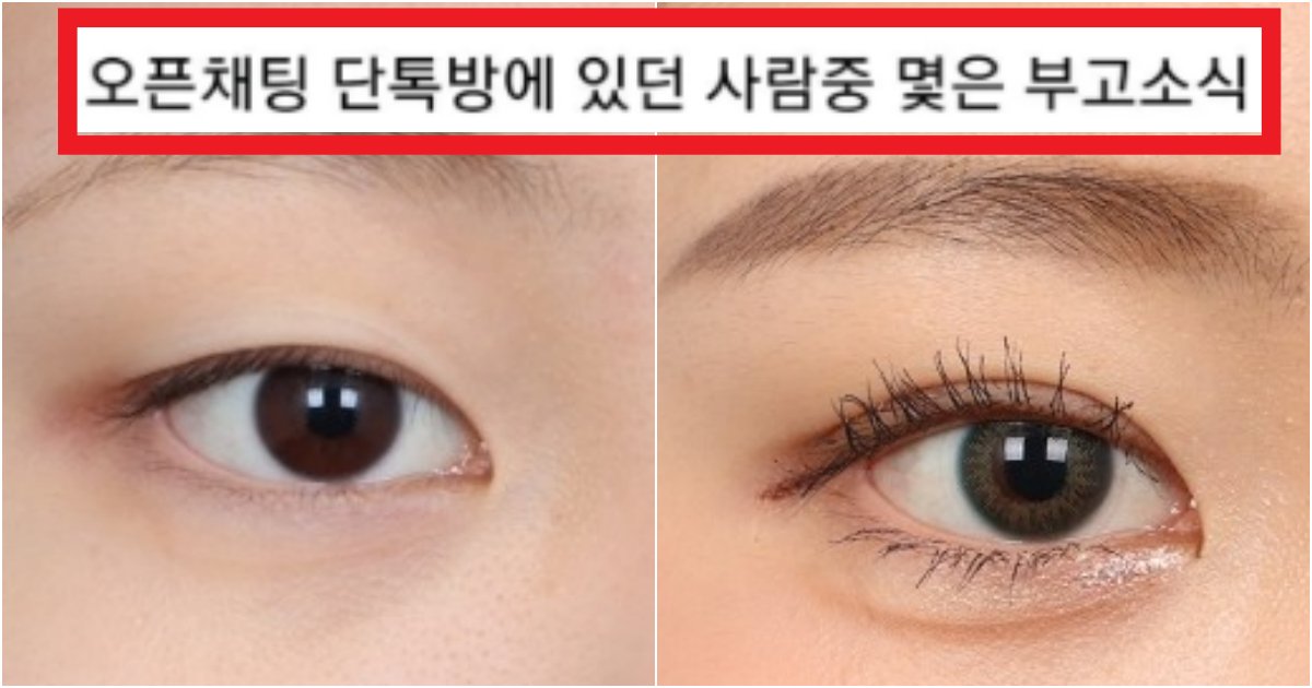 collage 137.png?resize=412,275 - '나 이명 생겼는데..' 눈매교정했다가 수술로 해결도 못해서 부작용 제대로 와버린 많은 사람들 근황(+댓글 반응)