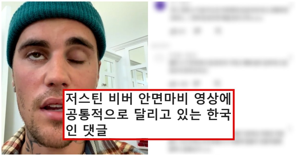collage 141.png?resize=1200,630 - 안면마비 걸린 저스틴비버에게 한국인들이 '이구동성'으로 하고 있는 말 (+사진)